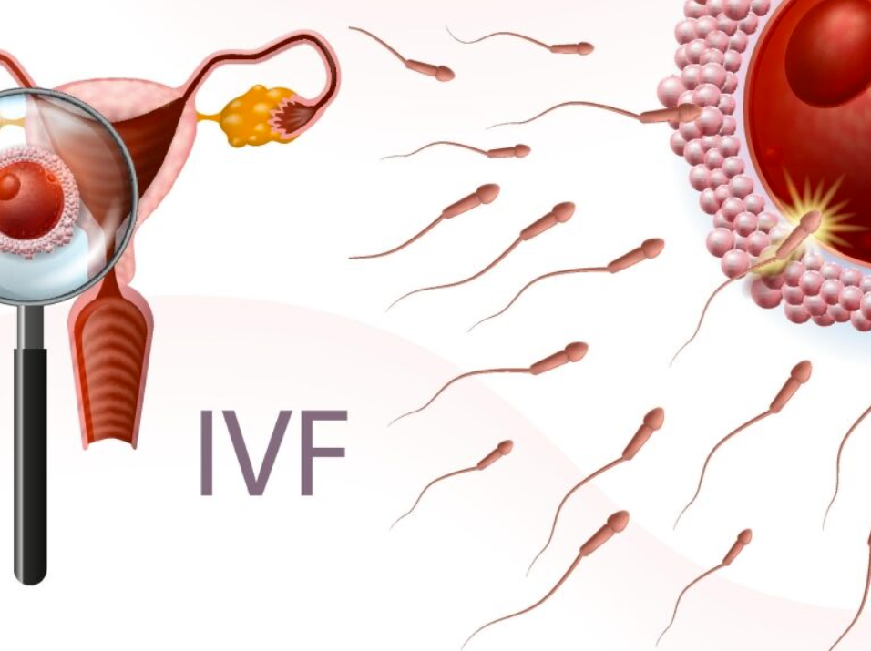Kiến thức IVF